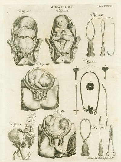 Geburtshilfe, Illustration aus 
